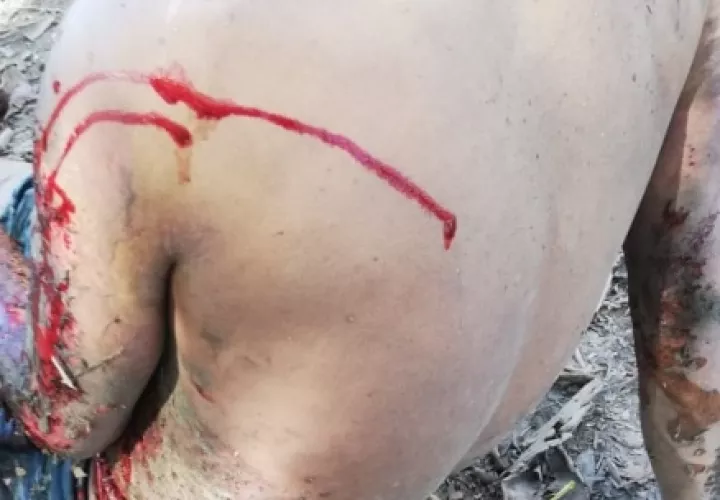 La oficina de Seguridad de los bomberos investiga la causa de la explosión, ya que según los vecinos del lugar es la cuarta vez que se registra un inicdente en ese local.