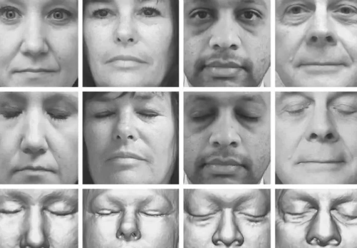 Un programa de reconocimiento facial identificó a 70 de 84 participantes en un estudio. Foto/ Mayo Clinic, via New England Journal of Medicine.