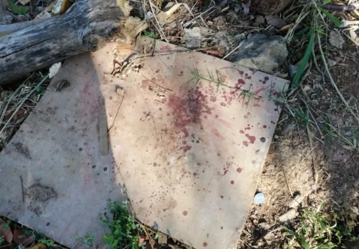 El ciudadano asiático de 51 años fue herido en un brazo. Foto/José Vásquez