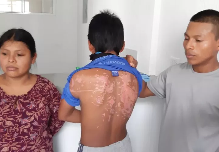 Heridas que no se borran. FOTO/MELQUIADES VÁSQUEZ