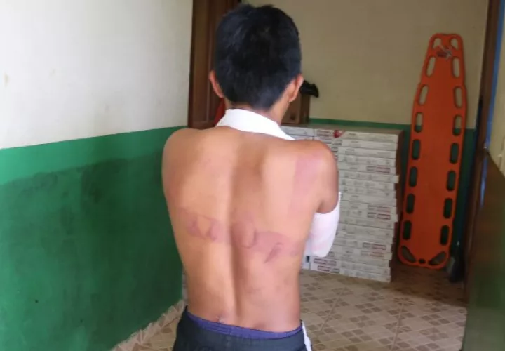 Un joven logró escapar de la iglesia y recibió ayuda médica. Foto/Melquiades Vásquez