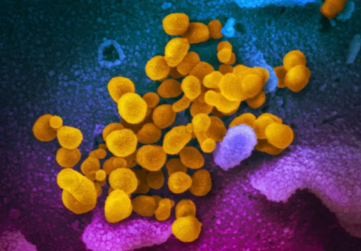 Más de 2,800 personas han muerto por el coronavirus (COVID-19). Foto: Archivo/Ilustrativa.