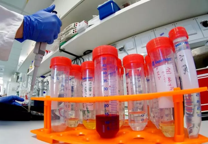 La paciente acudió a los servicios de salud donde, bajo los más estrictos protocolos, se le desarrollaron las pruebas de Covid-19 (coronavirus). 