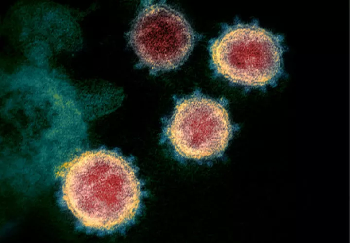 Una imagen microscópica del virus que causa el COVID-19. Foto:AP.