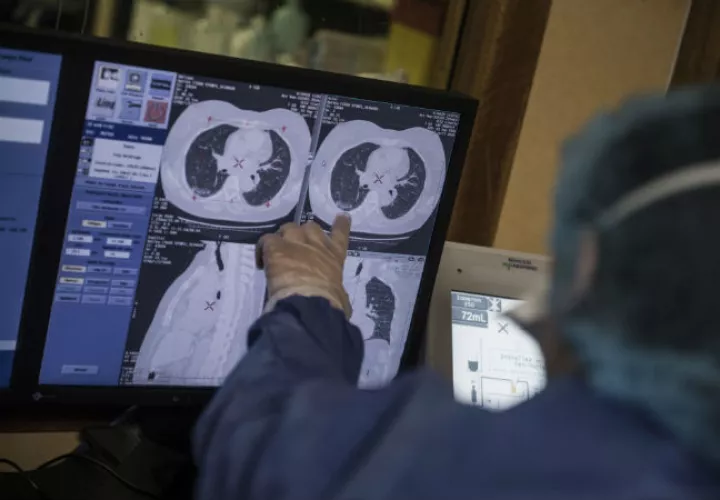 La investigación surge tras observaciones en no afectados que eran fumadores. Fotos: EFE.