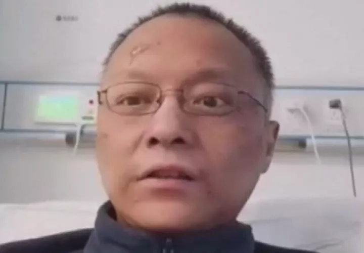 Las imágenes de la cara visiblemente oscurecida de los doctores Yi Fan y Hu Weihen, del Hospital Central de Wuhan, se volvieron virales primero en las redes chinas y posteriormente dieron el salto a las plataformas occidentales.