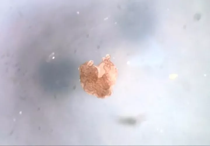Un xenobot vive una semana alimentándose de las plaquetas de yema en cada célula. Su forma determina su función. Foto / Centro de Biología Regenerativa y del Desarrollo, Universidad de Tufts.