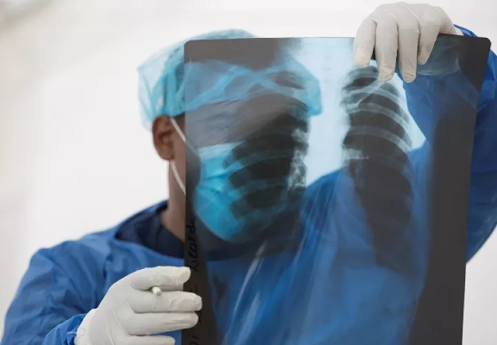 El personal médico es limitado y en esta fase de la pandemia está agotado.