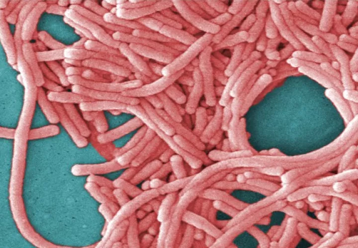 Una imagen de un microscopio electrónico de barrido coloreada de manera digital proporcionada por Janice Haney Carr/Centros para el Control y la Prevención de Enfermedades muestra la Legionella pneumophila, la bacteria que causa la enfermedad del legionario. (Janice Haney Carr/Centros para el Control y la Prevención de Enfermedades vía The New York Times).