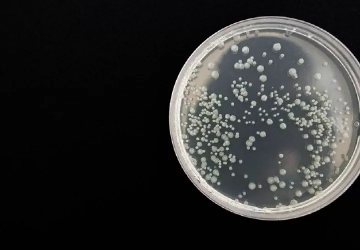Por más de 100 años se sospechaba de la existencia la bacteria, pero no había evidencia científica. Foto: Ilustrativa / Pixabay