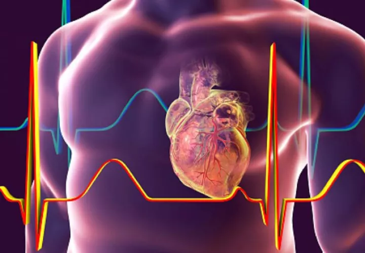 Se requiere más precaución y supervisión para los pacientes con enfermedades cardiovasculares.  Pixabay