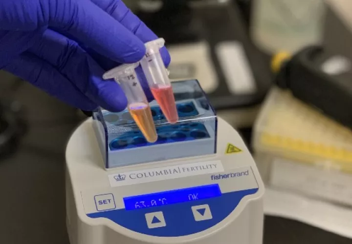 En el laboratorio de Zev Williams, los investigadores están desarrollando una prueba con saliva que arrojará resultados claros en unos 30 minutos. Foto / Dr. Zev Williams/Universidad de Columbia.