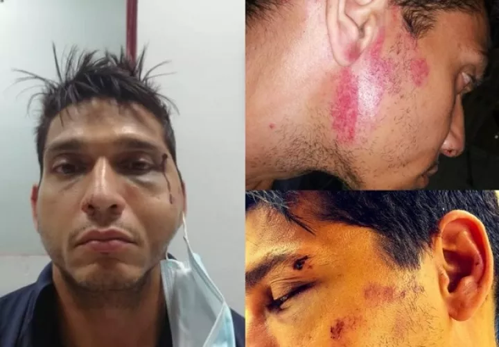 El taxista aseguró que presentó la denuncia sobre este supuesto abuso policial.
