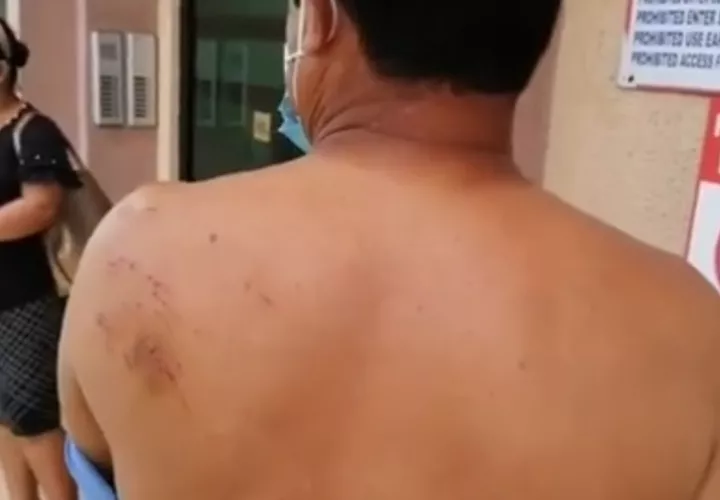 El denunciante dijo que las agresiones en su contra le dejaron fuertes golpes en diferentes partes del cuerpo, ya que fue brutalmente golpeado al punto de que prácticamente perdía la respiración.