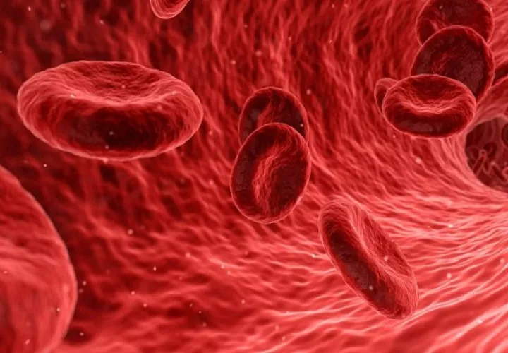 La Leucemia Mieloide Aguda (LMA) es un cáncer de la sangre y la médula ósea de rápida progresión. Foto: Pixabay