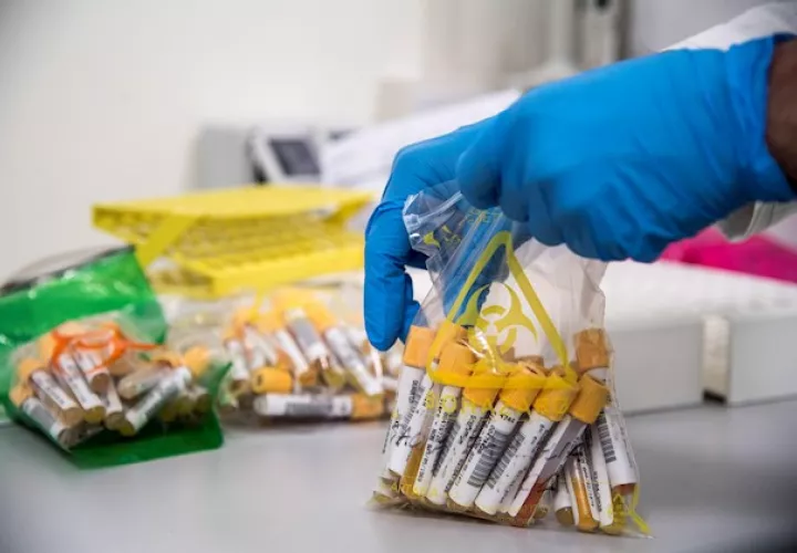 El estudio observa que ambas enfermedades alteran los niveles de citocinas (medidores de la inflamación) involucradas en la respuesta inmune, pero con algunas diferencias.