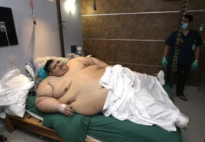  Juan Pedro Franco, pesa ahora, después de tres cirugías y un largo proceso de más de tres años, entre 200 y 210 kilos, 70 de los cuales pertenecen a piel sobrante que le será retirada, y contrajo el coronavirus con sus enfermedades comórbidas "controladas", según su médico. FOTO/EFFE