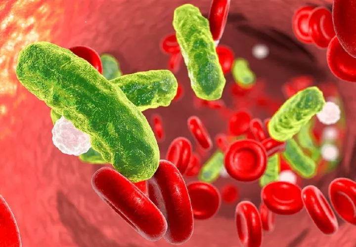 La sepsis es una disfunción orgánica potencialmente mortal.  Pixabay