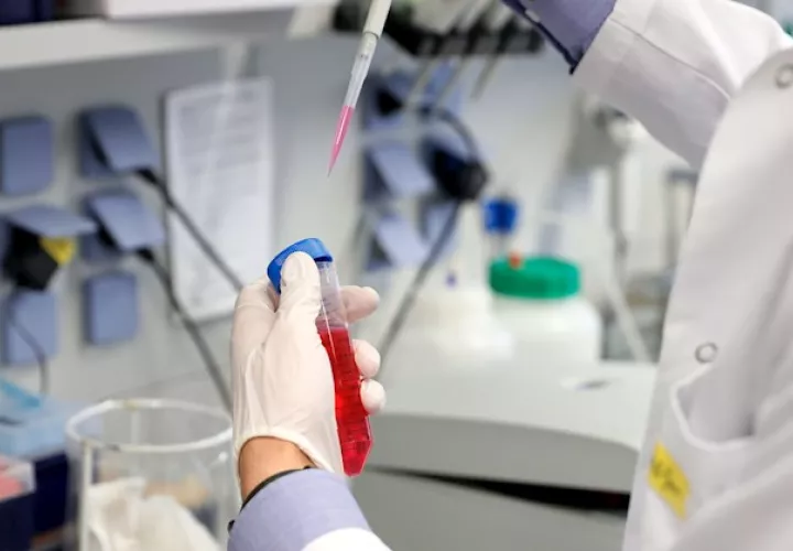 Las inversiones para afrontar la producción de dosis a gran escala dependerán del éxito de los ensayos clínicos, la disponibilidad de acuerdos de adquisición anticipados, la confirmación de los fondos y la mejora de las vías de registro y regulación, de acuerdo con los fabricantes.