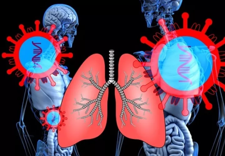Los pacientes pueden presentar diferentes síntomas. Foto: Ilustrativa / Pixabay