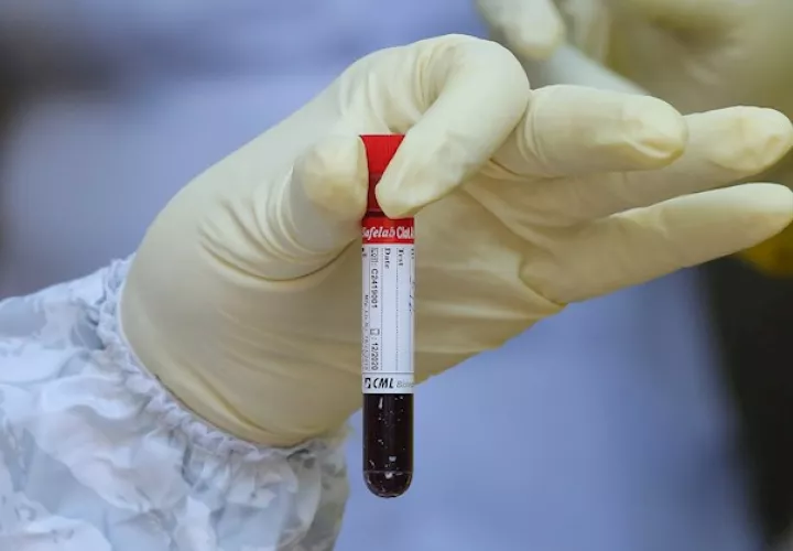 En junio pasado, un artículo publicado en New England Journal of Medicine señalaba que los genes pueden determinar que algunas personas desarrollen formas graves de covid y que tener sangre tipo A se asociaba a un 50 % más de riesgo de necesidad de apoyo respiratorio, mientras que el grupo O confería "efecto protector".