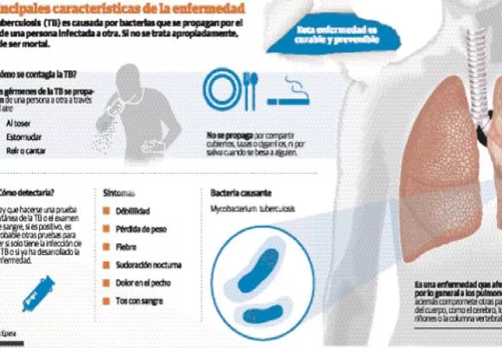A  nivel mundial  en el 2019 murió un millón 400 mil personas por tuberculosis.