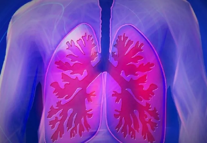 El dispositivo que fue aprobado por la FDA en 2019, ha mostrado mejora en la respiración sin cirugía mayor. Foto: Ilustrativa / Pixabay
