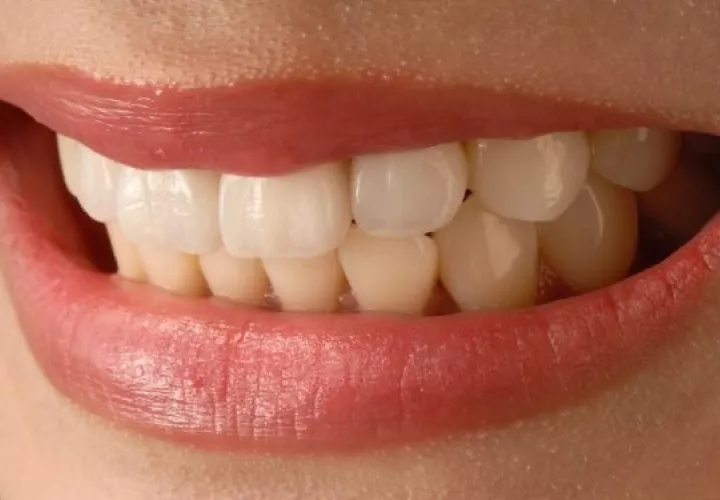 Los dientes de ambas arcadas están en contacto durante el día. Foto: Ilustrativa / Pixabay