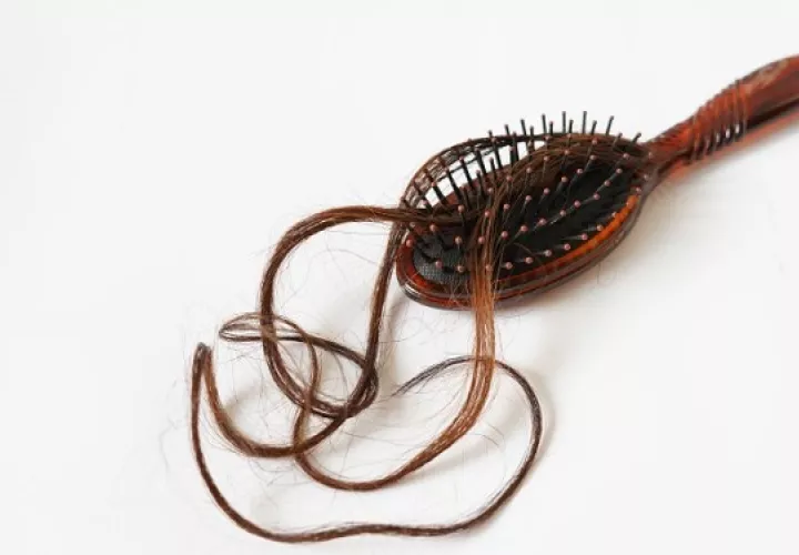 En las mujeres una de las causas más comunes de la caída del cabello son los cambios hormonales. Foto: Ilustrativa / Pixabay