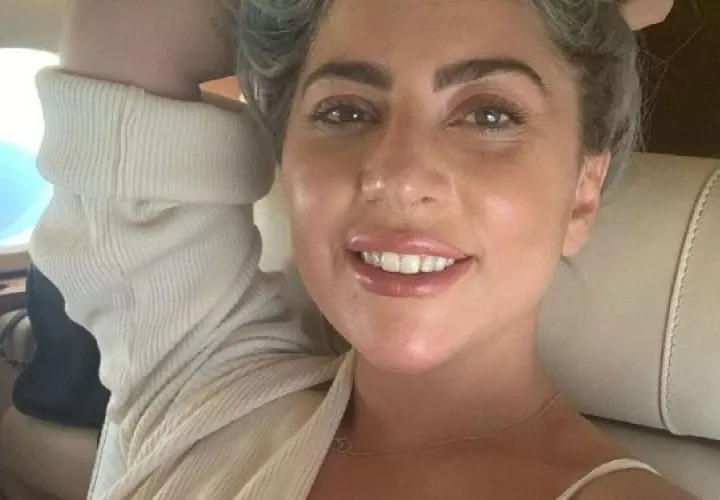 A Lady Gaga le robaron a sus dos perros: Koji y Gustav. Foto: Instagram