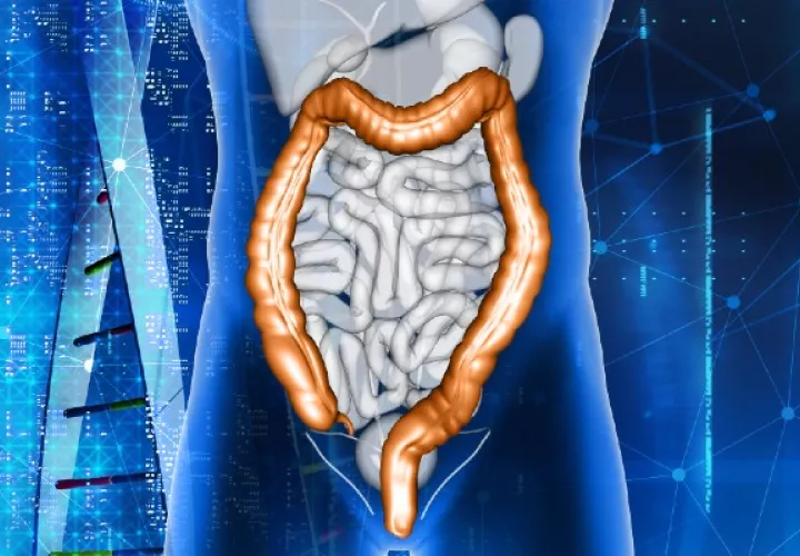 El cáncer colorrectal es el cuarto cáncer más común en la región de las Américas, según la Organización Panamericana de la Salud (OPS). Foto ilustrativa / Freepik.