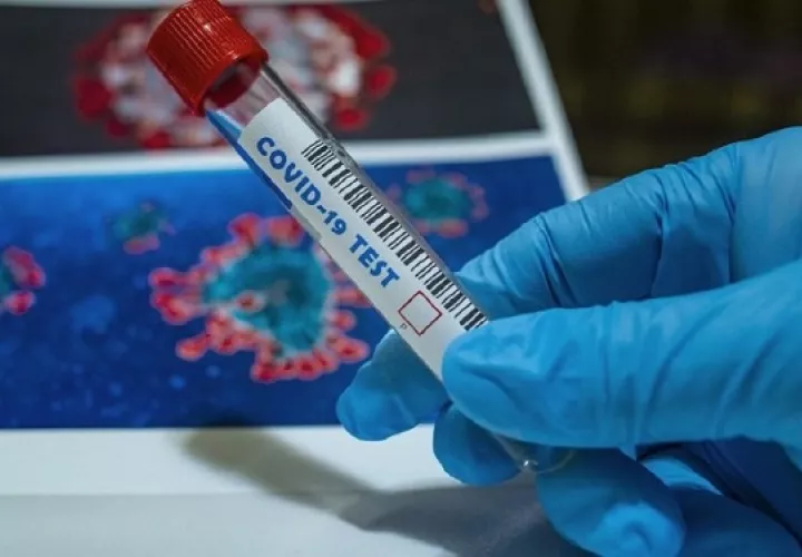 Las pruebas moleculares (PCR), indican si hay presencia del material genético del virus o no. Foto: Ilustrativa / Pixabay