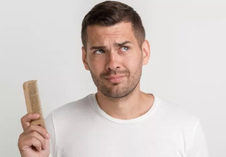 No todos los casos de alopecia o pérdida del cabello son iguales. Cortesía