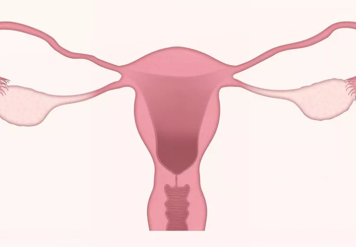 Un enemigo que pone en riesgo la fertilidad de las mujeres.  Foto: Ilustrativa / Pixabay