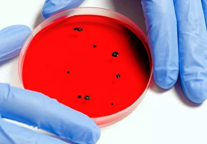 Se estudia cómo prevenir la resistencia a los antimicrobianos. Foto: Ilustrativa / Pexels
