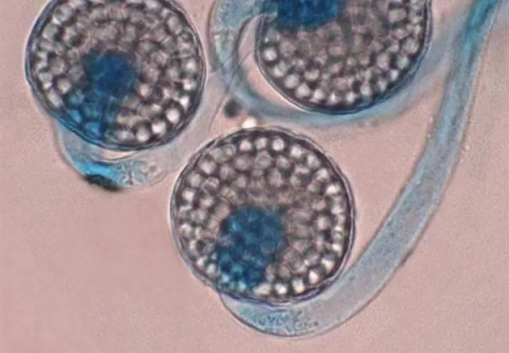  Imagen tomada a través de un microscopio que muestra un hongo Circinella lampensis. EFE
