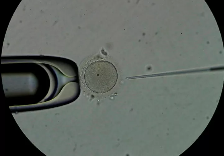 Personal técnico trabaja con espermatozoides en el laboratorio de la clínica Panama Fertility. Foto: EFE