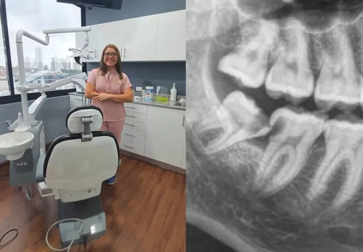 La doctora Yesneira Rodríguez aconseja realizar la extracción antes de los 25 años. Foto: Cortesía Y. Rodríguez