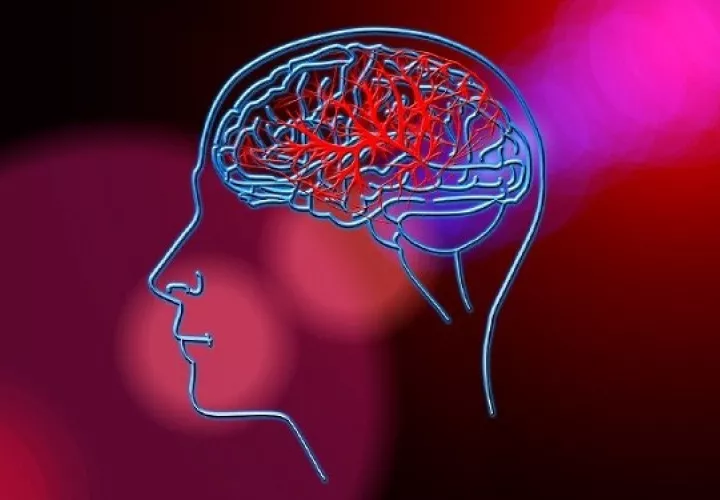 La terapia del lenguaje suele ayudar a personas con afección del habla por un accidente cerebrovascular.  Foto: Ilustrativa / Pixabay