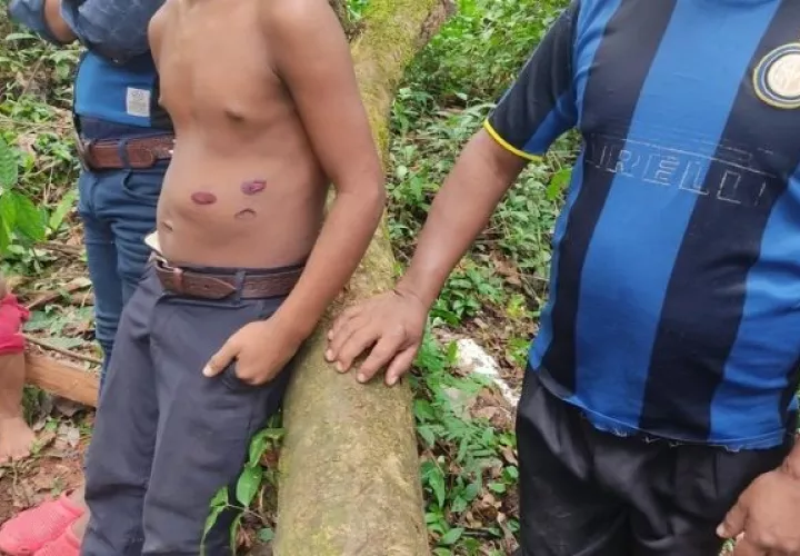  Varios menores de edad resultaron heridos con balas de goma. Foto: Defensoría del Pueblo