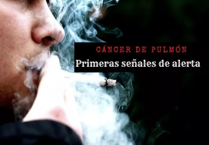 Más del 70% de las personas diagnosticadas en nuestra región tienen la enfermedad muy avanzada. Foto: Pixabay