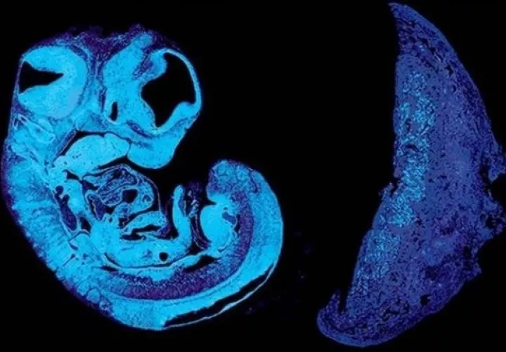 Secciones del feto y de la placenta. EFE