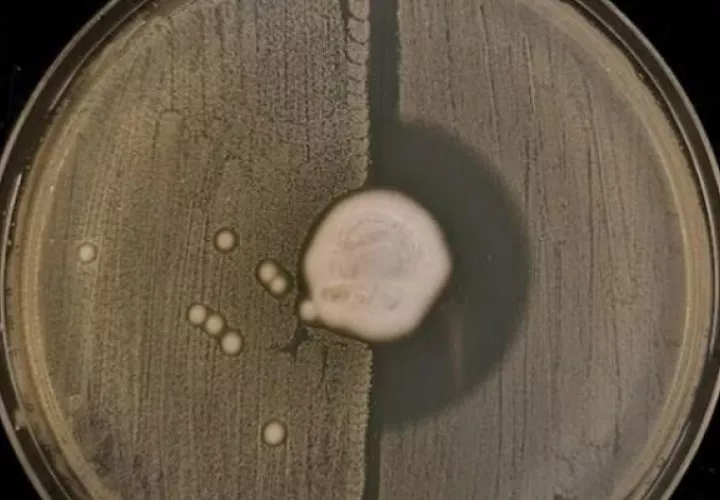 Hongo Trichophyton erinacei creciendo en el centro de una placa de agar con SARM en la mitad izquierda y la bacteria Staphylococcus aureus a la derecha. EFE