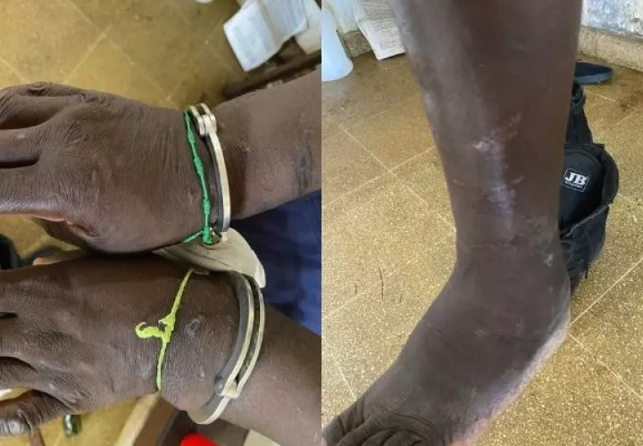 Caso de reo con trastorno psiquiátrico y en condiciones infrahumanos en La Joya alerta a la Defensoría del Pueblo. Foto: Cortesía