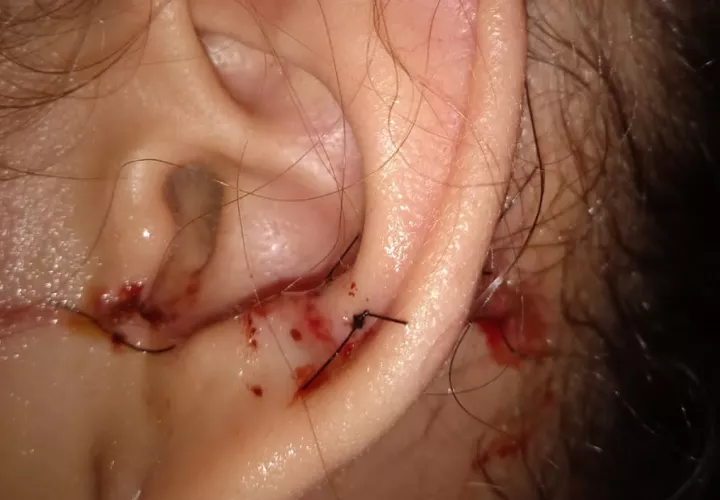 La menor fue llevada por su padre a recibir atención médica. Foto: José Vásquez