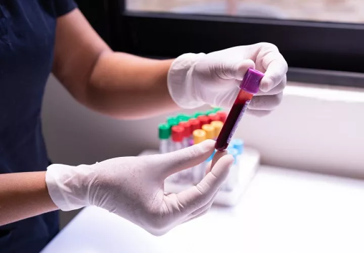 Los exámenes de sangre son importantes para conocer los niveles de colesterol. Foto: Pexels