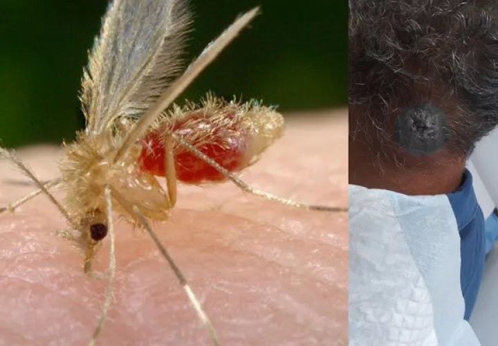Quienes viven en lugares cercanos a áreas verdes estarían más expuestos. Foto: CSS/CDC