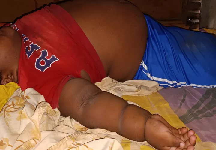 El menor mayormente afectado pesa unas 200 libras. Foto: Melquiades Vásquez 