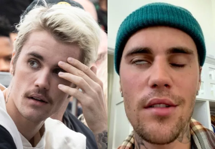 Justin Bieber necesita tiempo y por eso canceló algunos espectáculos la última semana. Fotos: EFE / Instagram