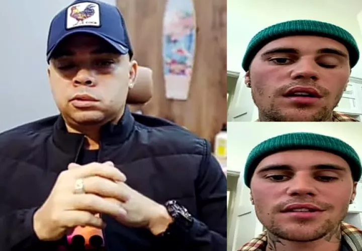 artistas_paralisis_pa1.jpg